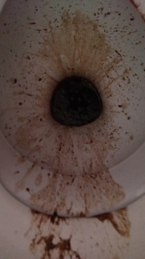 Close-up view of a toilet bowl. A significant amount of blood is present in the bowl, splattered around the drain.