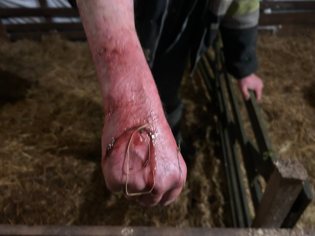 Charlie’s hand and wrist covered in placenta blood and fluid, having pulled out a stuck new born lamb from a mother ewe. Charlies dark clothing and partially visible high-visibility jacket are also visible.