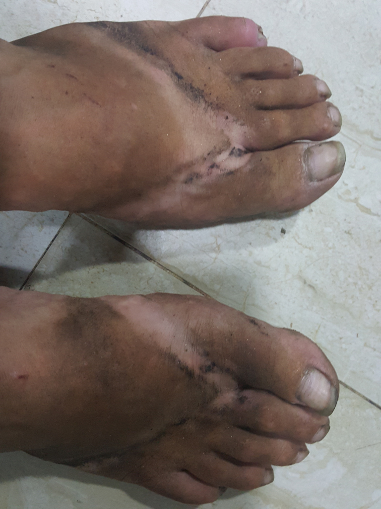 Close-up, high-angle view of a pair of bare feet, heavily soiled with dark brown dirt and grime, positioned on a light beige tiled floor. The feet are positioned relatively flat on the ground, with toes slightly splayed. The dirt clings to the skin, particularly concentrated in streaks and patches along the arches and heels. The dirt appears dry and granular. There are minor scrapes and cuts visible on the skin, especially noticeable on the left foot (viewer's perspective). The toenails are trimmed but slightly discoloured and dirty. 